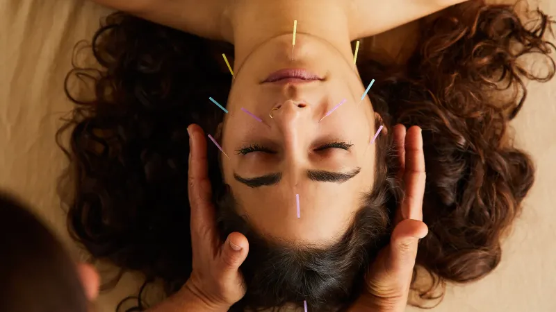 acupuntura facial